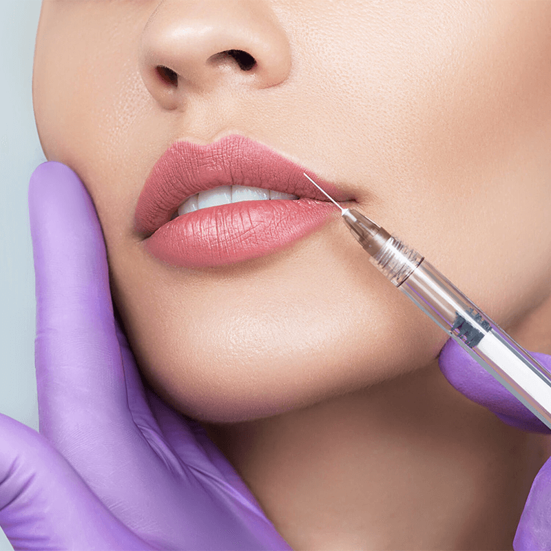 Dermal Fillers